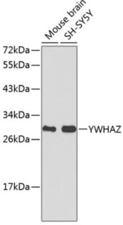 HspB2 Rabbit anti-Human, Mouse, Polyclonal, Novus Biologicals:Antibodies:Primary